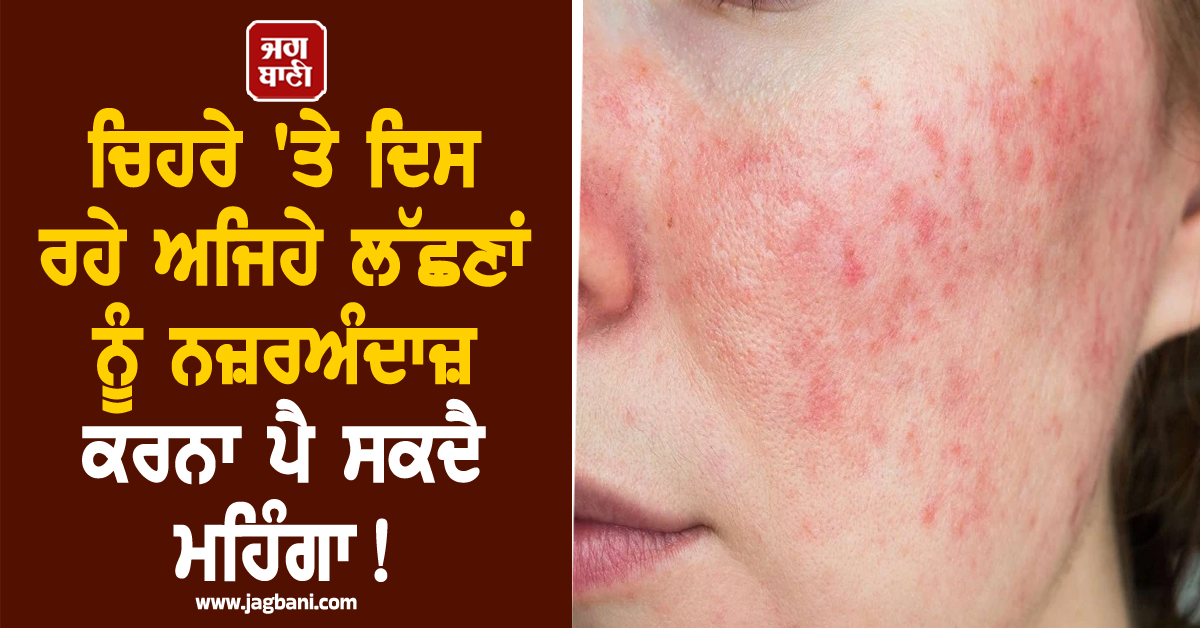 ਚਿਹਰੇ 'ਤੇ ਦਿਸ ਰਹੇ ਅਜਿਹੇ ਲੱਛਣਾਂ ਨੂੰ ਨਜ਼ਰਅੰਦਾਜ਼ ਕਰਨਾ ਪੈ ਸਕਦੈ ਮਹਿੰਗਾ ! ਜਾਣੋ ਇਸ ਦੇ ਮੁੱਖ ਕਾਰਨ ਅਤੇ ਘਰੇਲੂ ਉ