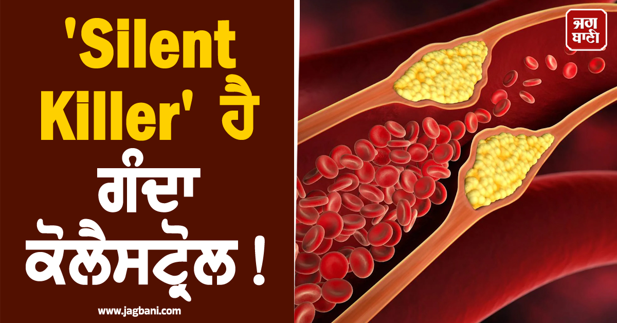 'Silent Killer' ਹੈ ਗੰਦਾ ਕੋਲੈਸਟ੍ਰੋਲ! ਸਰੀਰ 'ਚ ਦਿਖਣ ਇਹ 5 ਬਦਲਾਅ, ਤਾਂ ਤੁਰੰਤ ਹੋ ਜਾਓ ਸਾਵਧਾਨ, ਅਪਣਾਓ ਦੇਸੀ ਨੁਸ