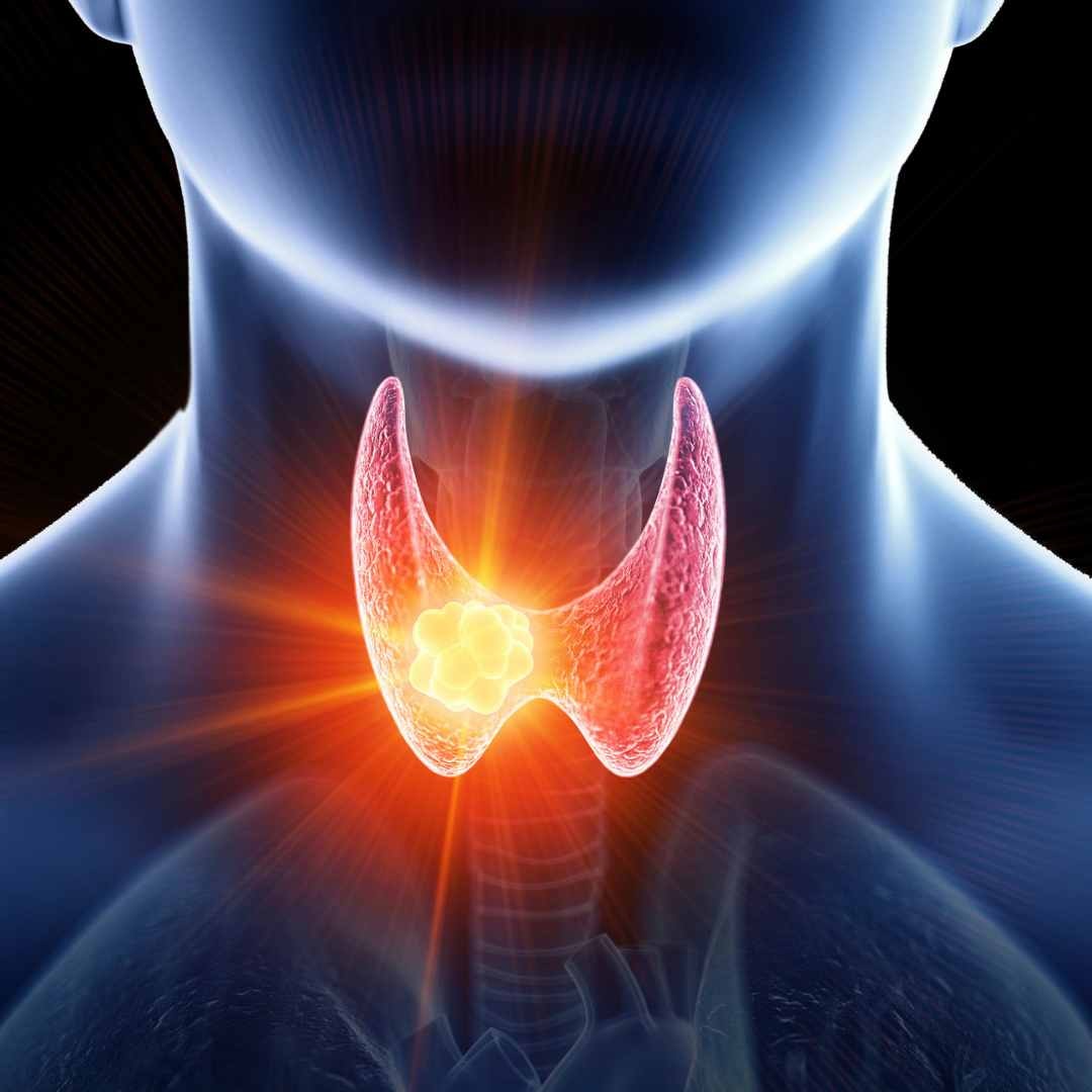 Thyroid ਦੀ ਸਮੱਸਿਆ ਜੜ੍ਹ ਤੋਂ ਹੋ ਜਾਵੇਗੀ ਖਤਮ! ਬਸ ਕਰ ਲਓ ਇਹ ਕੰਮ