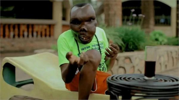 baguma becomes the ugliest person in the world