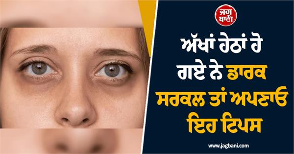 dark circles under your eyes then follow these tips