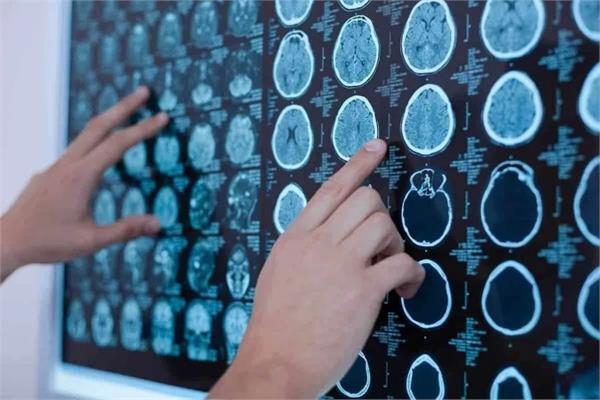 brain tumor treatment