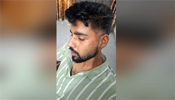 youth injured in attack dies in ludhiana dmc