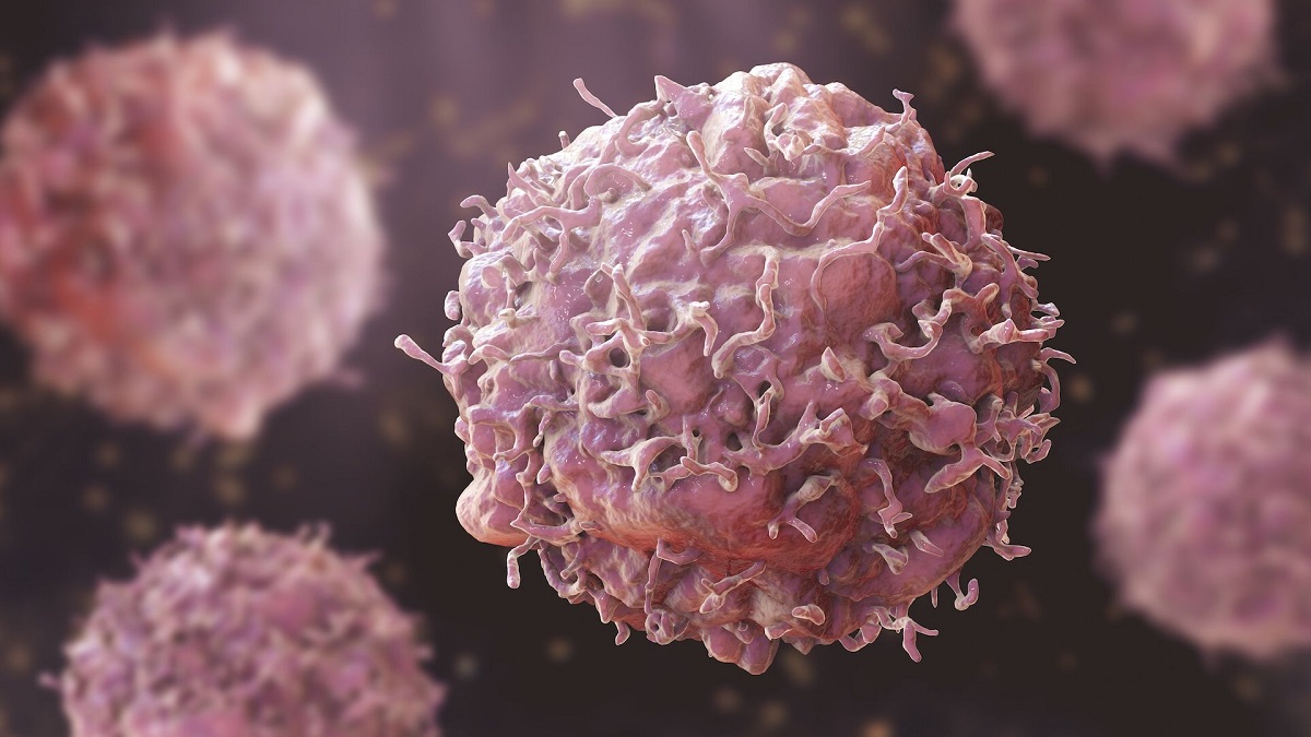 ਕੀ ਤੁਸੀਂ ਜਾਣਦੇ ਹੋ ਕੈਂਸਰ ਦੇ ਇਹ 5 ਸੱਚ ! ਹੋਇਆ ਵੱਡਾ ਖੁਲਾਸਾ