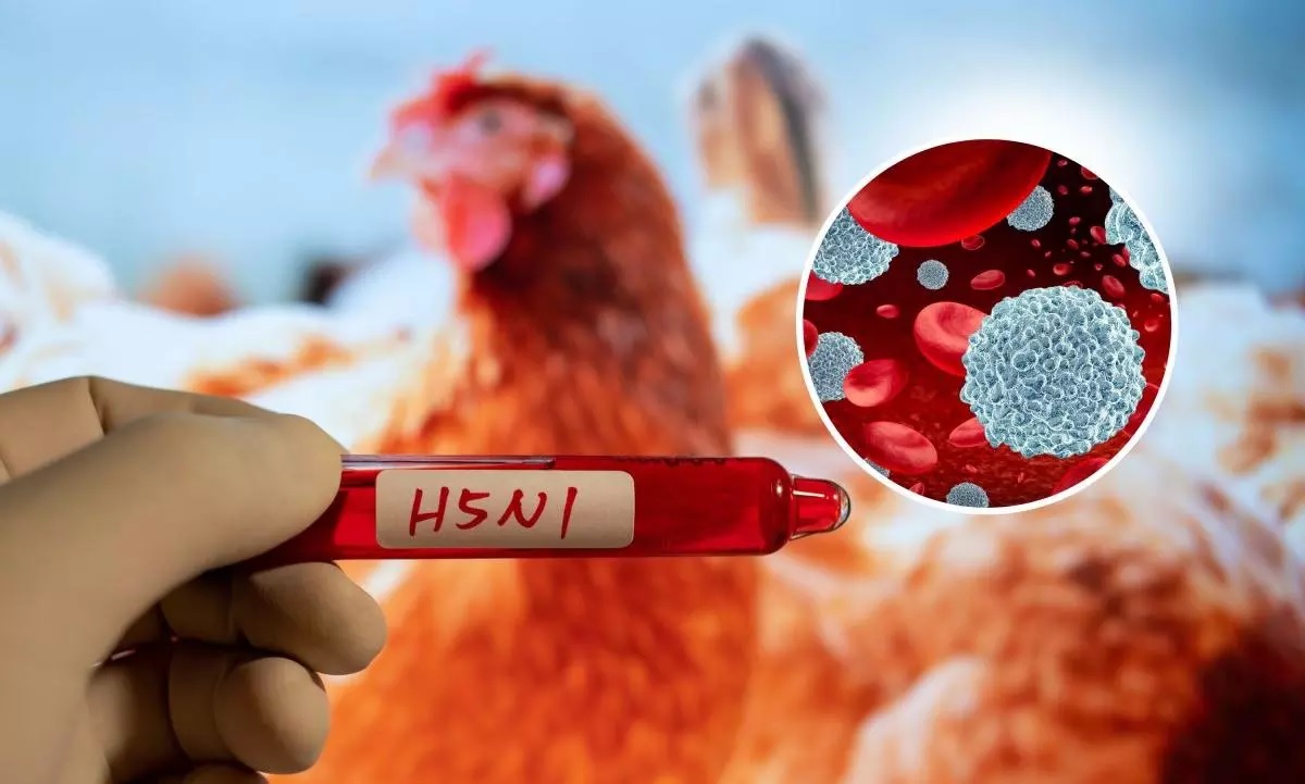 ਆਸਟ੍ਰੇਲੀਆ ''ਚ H5N1 ਬਰਡ ਫਲੂ ਦੇ ਮਾਮਲੇ 200 ਤੋਂ ਪਾਰ