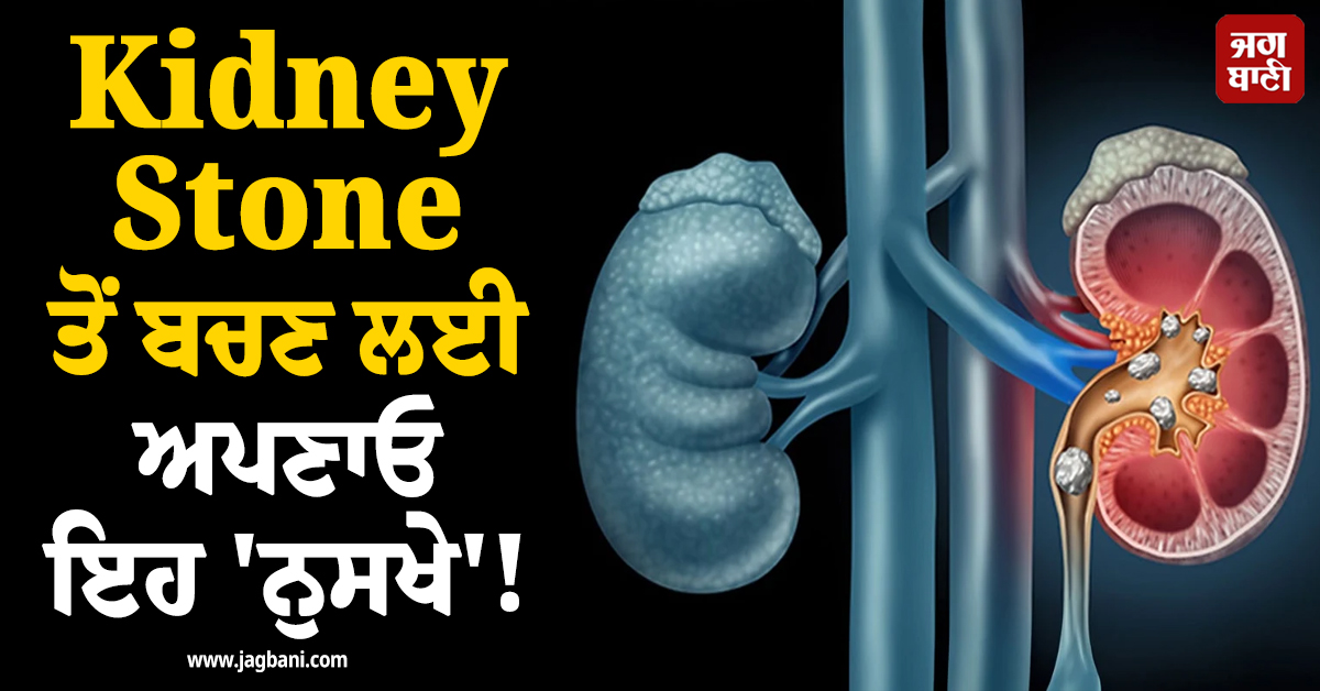 Kidney Stone ਤੋਂ ਬਚਣ ਲਈ ਅਪਣਾਓ ਇਹ 'ਨੁਸਖੇ' ! ਹੋਣ ਚਮਤਕਾਰੀ ਫਾਇਦੇ