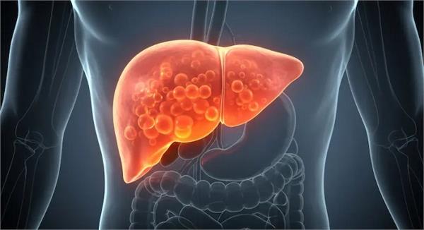 these healthy drinks will rapidly reduce the problem of fatty liver 