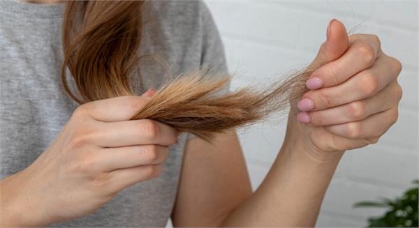 follow these home remedies for hair loss problem