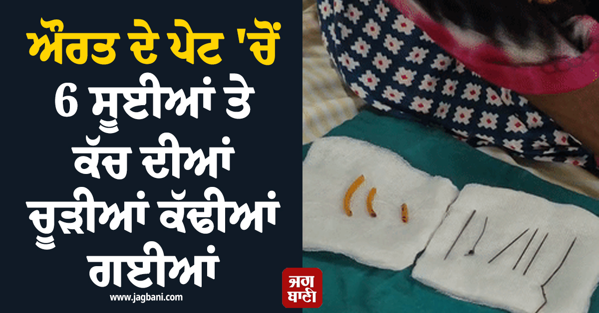 ਔਰਤ ਦੇ ਪੇਟ ਵਿੱਚੋਂ ਛੇ ਸੂਈਆਂ ਤੇ ਕੱਚ ਦੀਆਂ ਚੂੜੀਆਂ ਕੱਢੀਆਂ ਗਈਆਂ, ਹੈਰਾਨ ਕਰੇਗੀ ਪ੍ਰਯਾਗਰਾਜ ਦੀ ਘਟਨਾ
